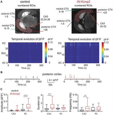 KCNQ2 channels regulate the population activity of neonatal GABAergic neurons ex vivo